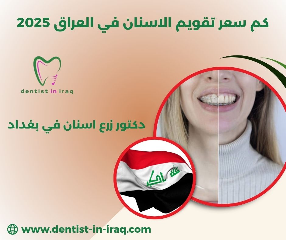كم سعر تقويم الاسنان في العراق كم سعر تقويم الاسنان في العراق