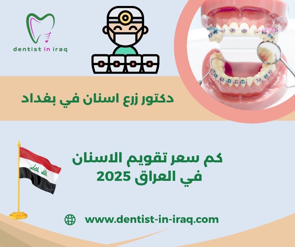 كم سعر تقويم الاسنان الشفاف في العراق كم سعر تقويم الاسنان الشفاف في العراق