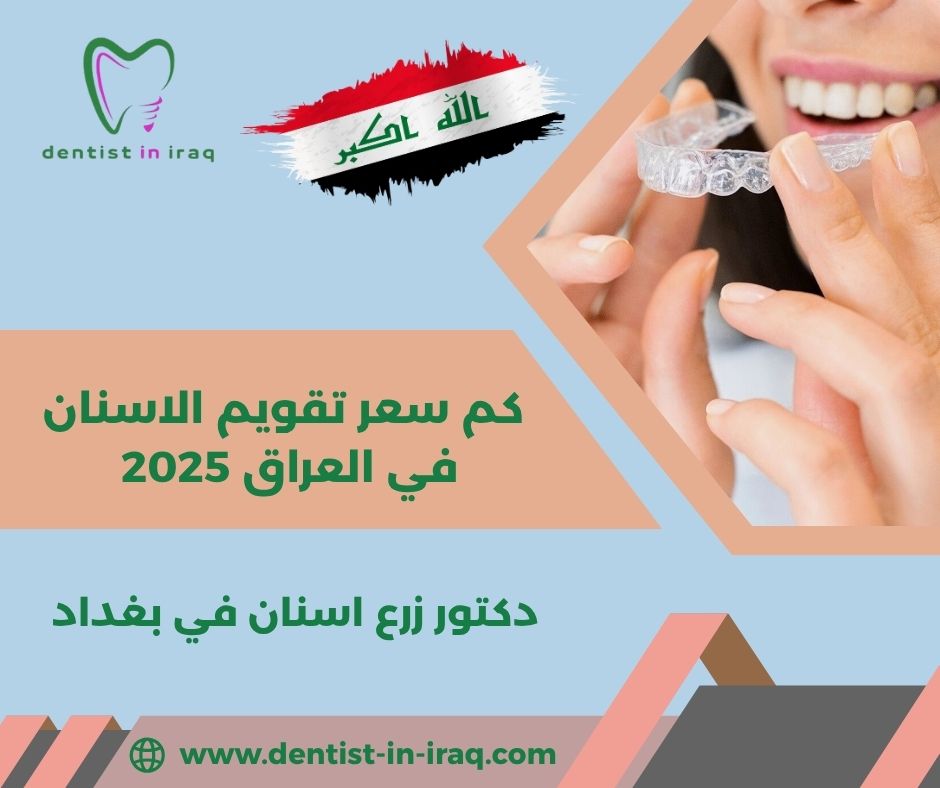 كم سعر تقويم الاسنان المعدني في العراق كم سعر تقويم الاسنان المعدني في العراق