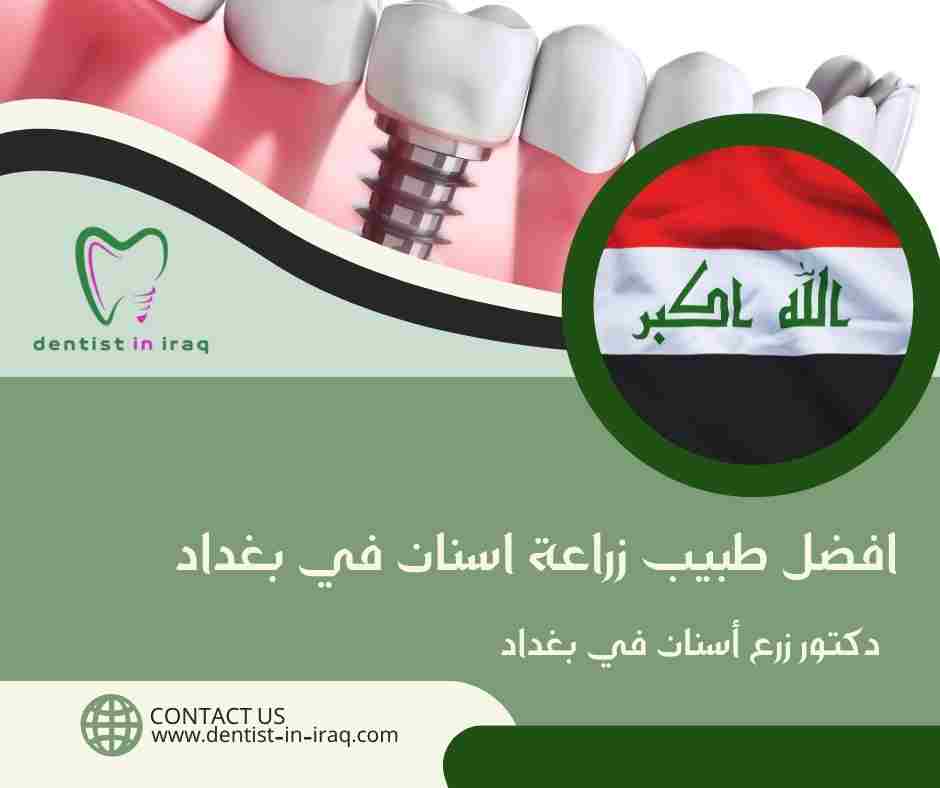 افضل طبيب زراعة اسنان في بغداد