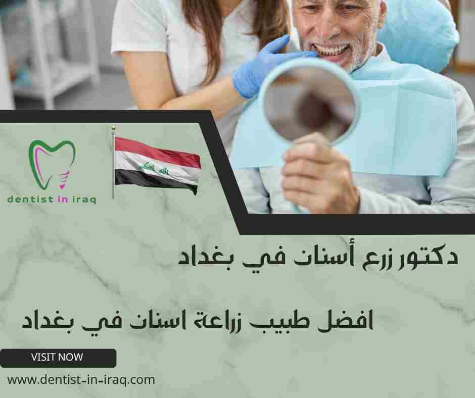 افضل طبيب زراعة اسنان في بغداد
