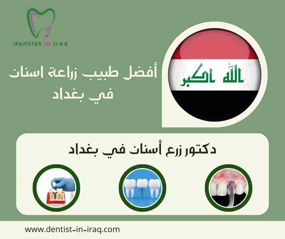 أفضل طبيب زراعة اسنان في بغداد