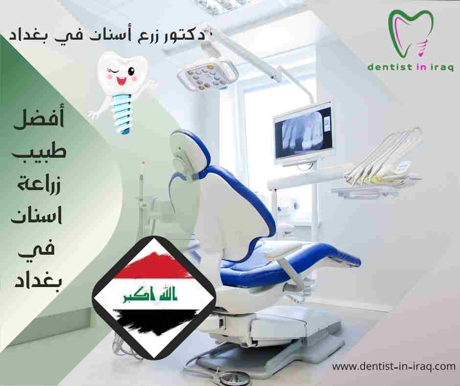 أفضل طبيب زراعة اسنان في بغداد