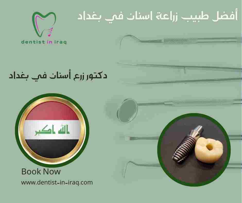 أفضل طبيب زراعة اسنان في بغداد