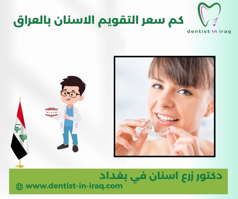 اسعار تقويم الاسنان في العراق اسعار تقويم الاسنان في العراق