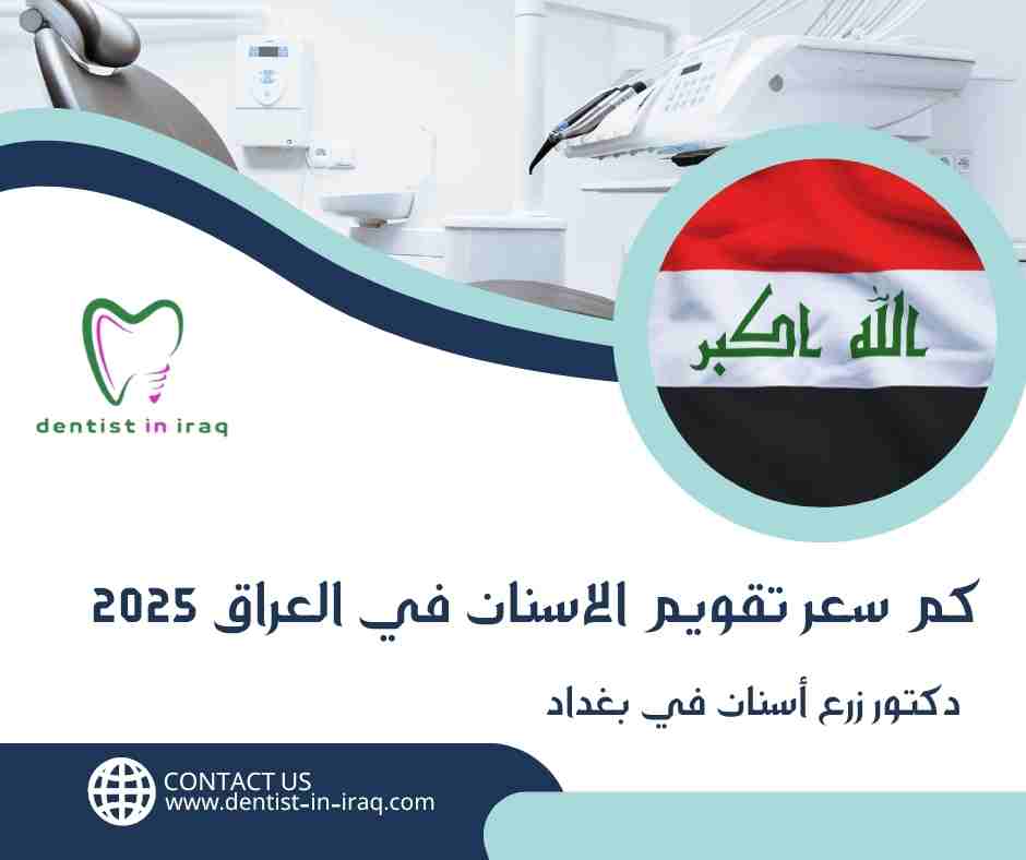 كم سعر تقويم الاسنان في العراق 2025