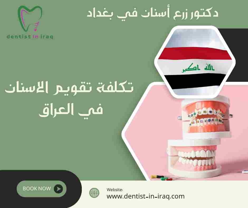تكلفة تقويم الاسنان في العراق