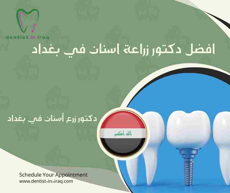 افضل دكتور زراعة اسنان في بغداد