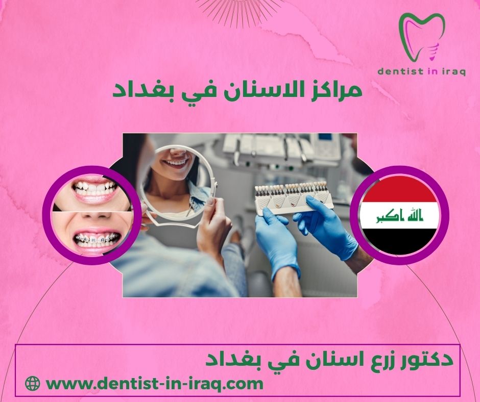 مراكز الاسنان في بغداد