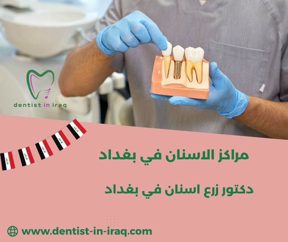 مراكز الاسنان التخصصية في بغداد مراكز الاسنان التخصصية في بغداد