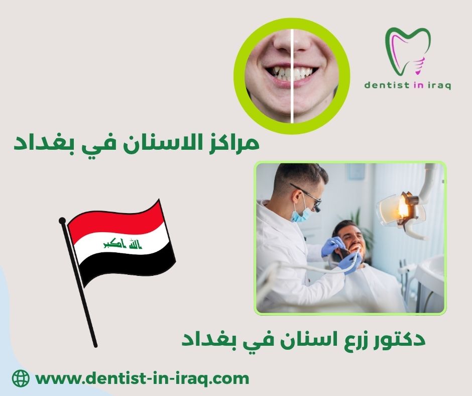 مراكز زراعة الاسنان في بغداد مراكز زراعة الاسنان في بغداد