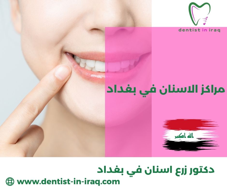 مراكز تجميل الاسنان في بغداد مراكز تجميل الاسنان في بغداد