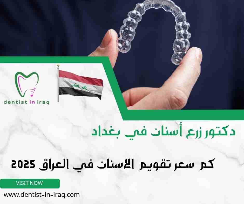 كم سعر تقويم الاسنان في العراق 2025
