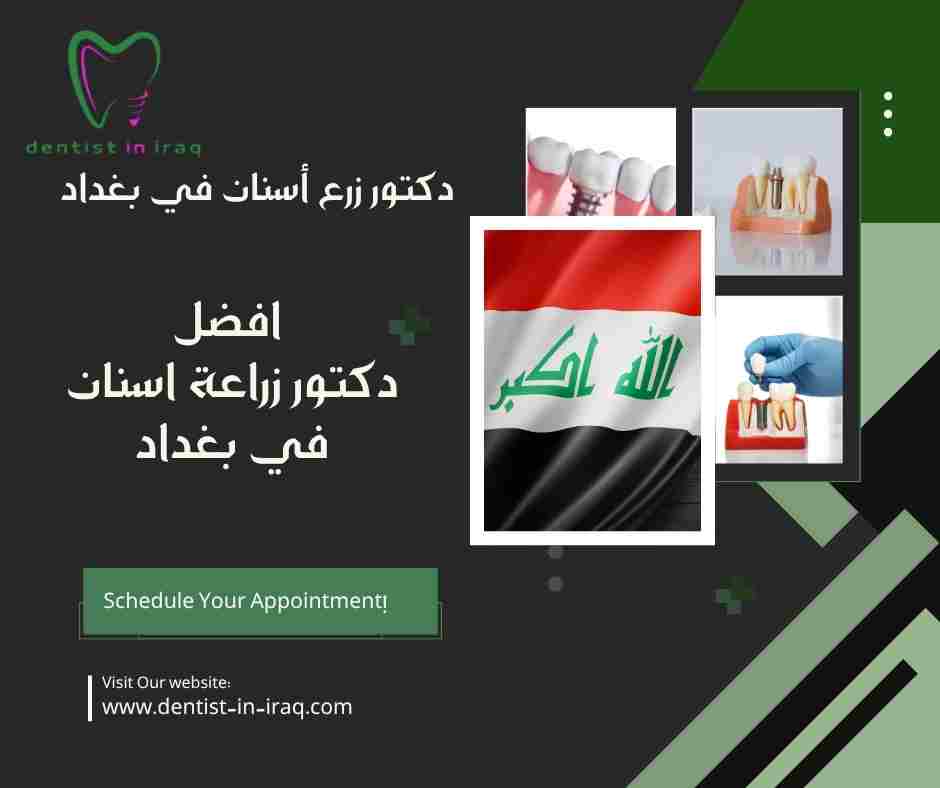افضل دكتور زراعة اسنان في بغداد