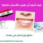 كيف أعرف أن طبيب الأسنان شاطر؟