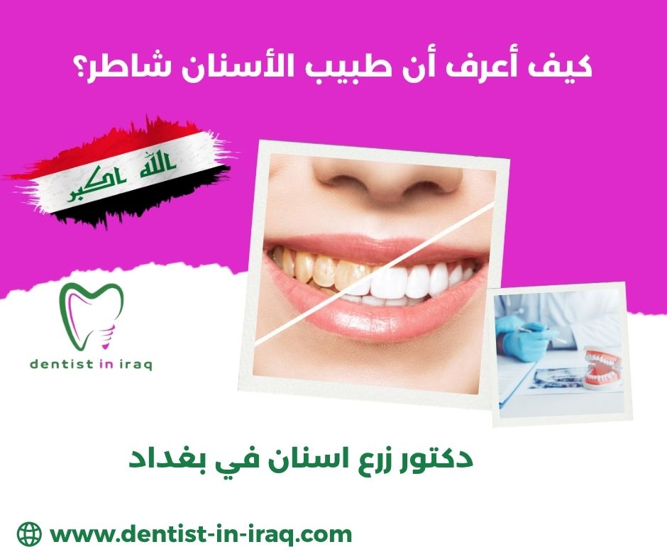 كيف أعرف أن طبيب الأسنان شاطر؟