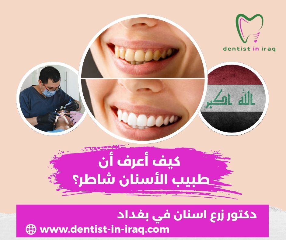 ما هي أسعار أسنان الزيركون في العراق؟ ما هي أسعار أسنان الزيركون في العراق؟