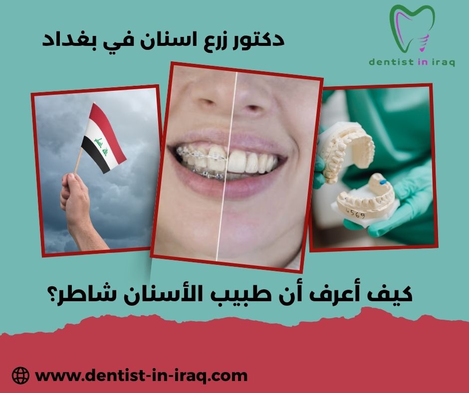 كيف تختار طبيب الأسنان المناسب؟ كيف تختار طبيب الأسنان المناسب؟