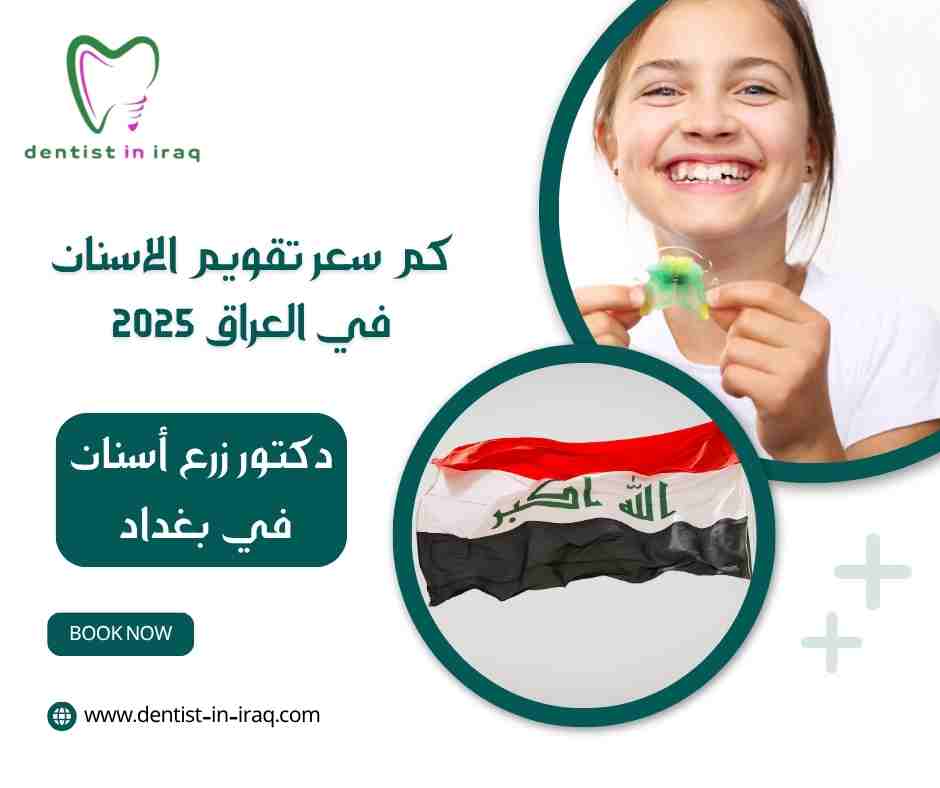 كم سعر تقويم الاسنان في العراق 2025