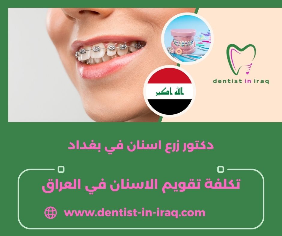 افضل طبيب اسنان في العراق