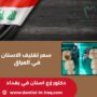 سعر تغليف الاسنان في العراق