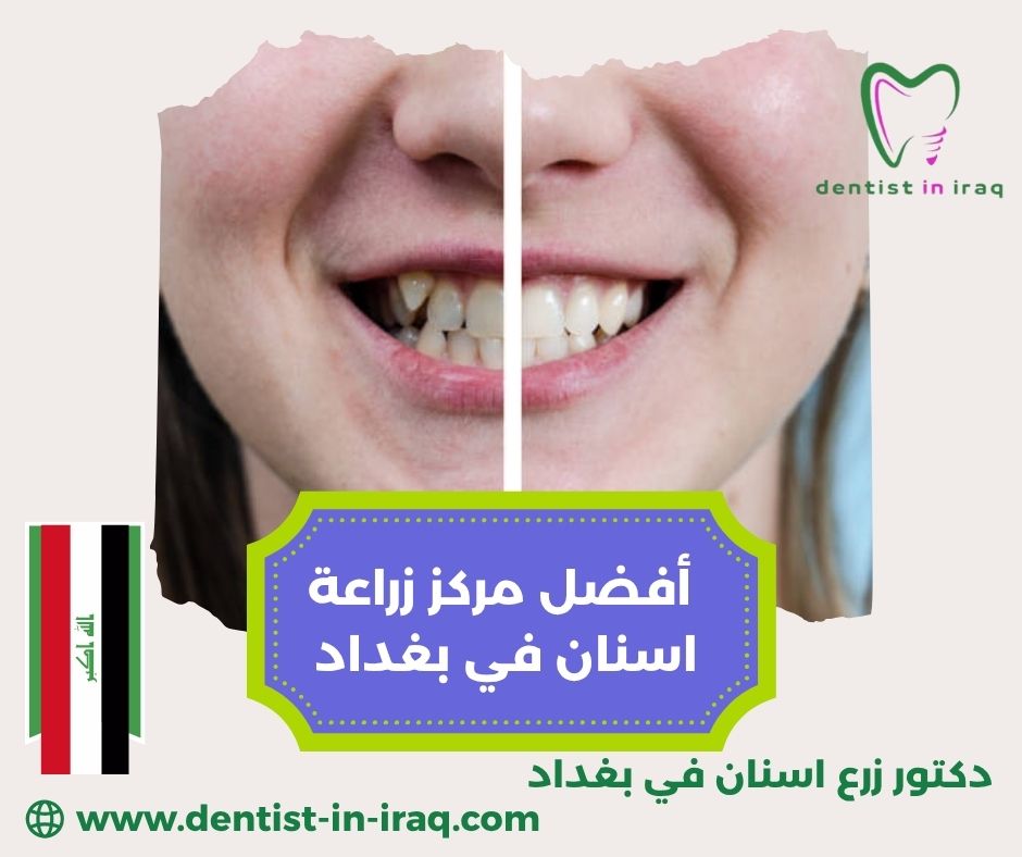 أفضل طبيب اسنان في بغداد
