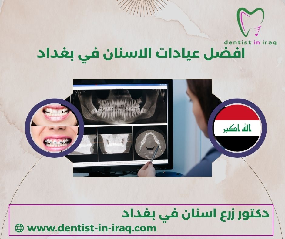 عيادات الاسنان في بغداد