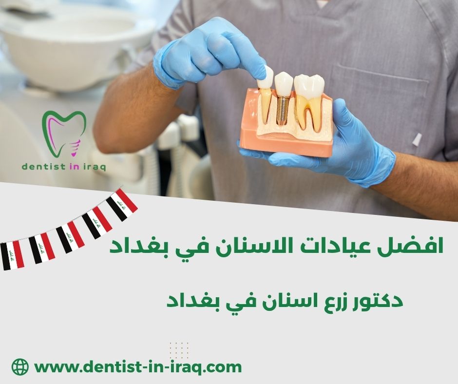 افضل عيادة اسنان في بغداد