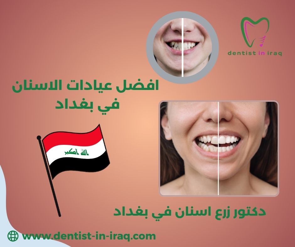 عيادات اسنان في بغداد