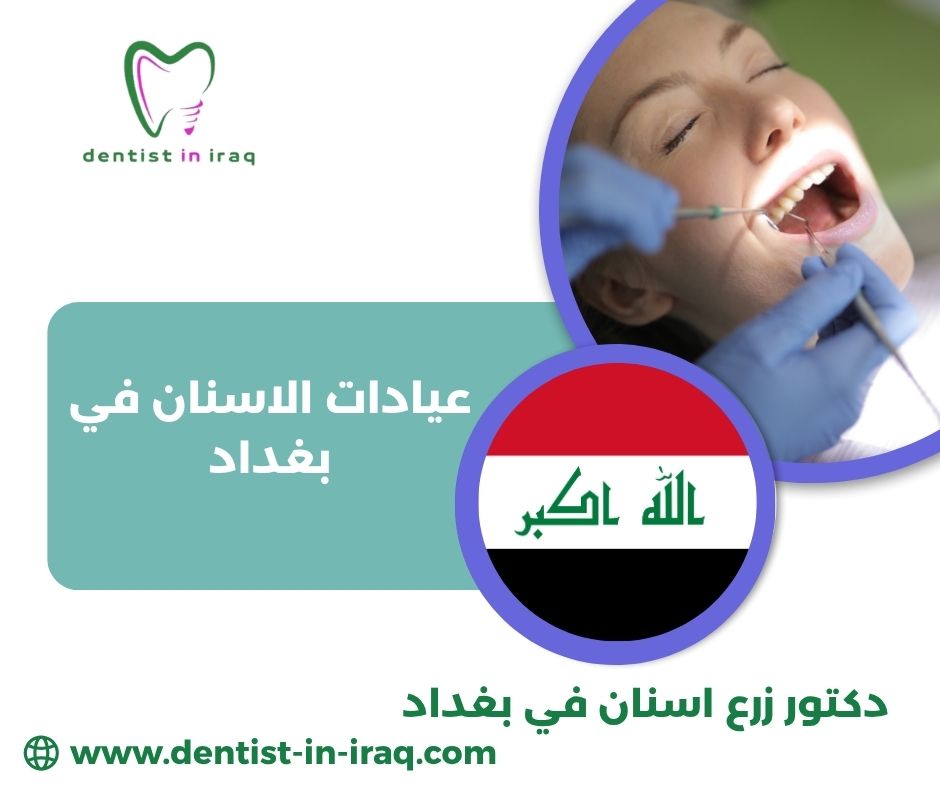 عيادات اسنان في بغداد