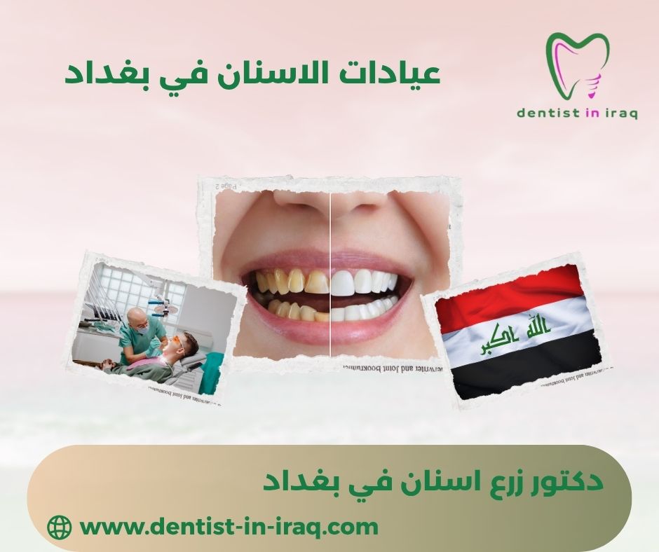 افضل عيادات الاسنان في بغداد
