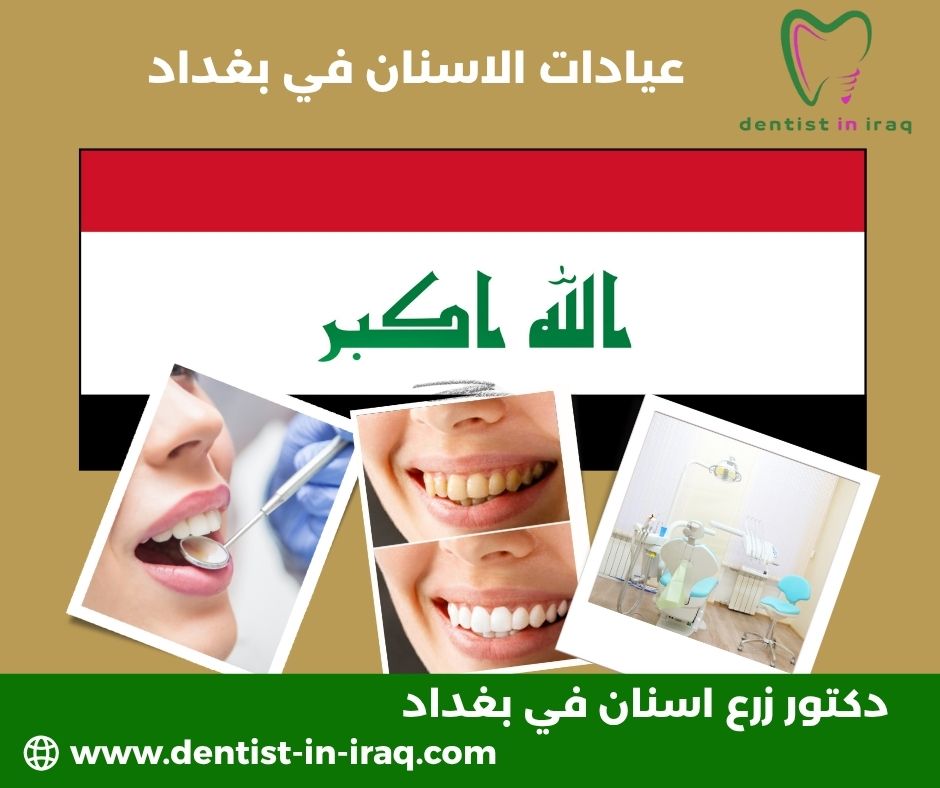 عيادات الاسنان في بغداد