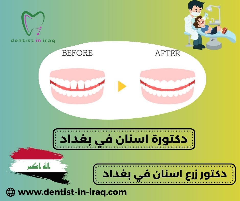 افضل دكتورة اسنان في بغداد افضل دكتورة اسنان في بغداد