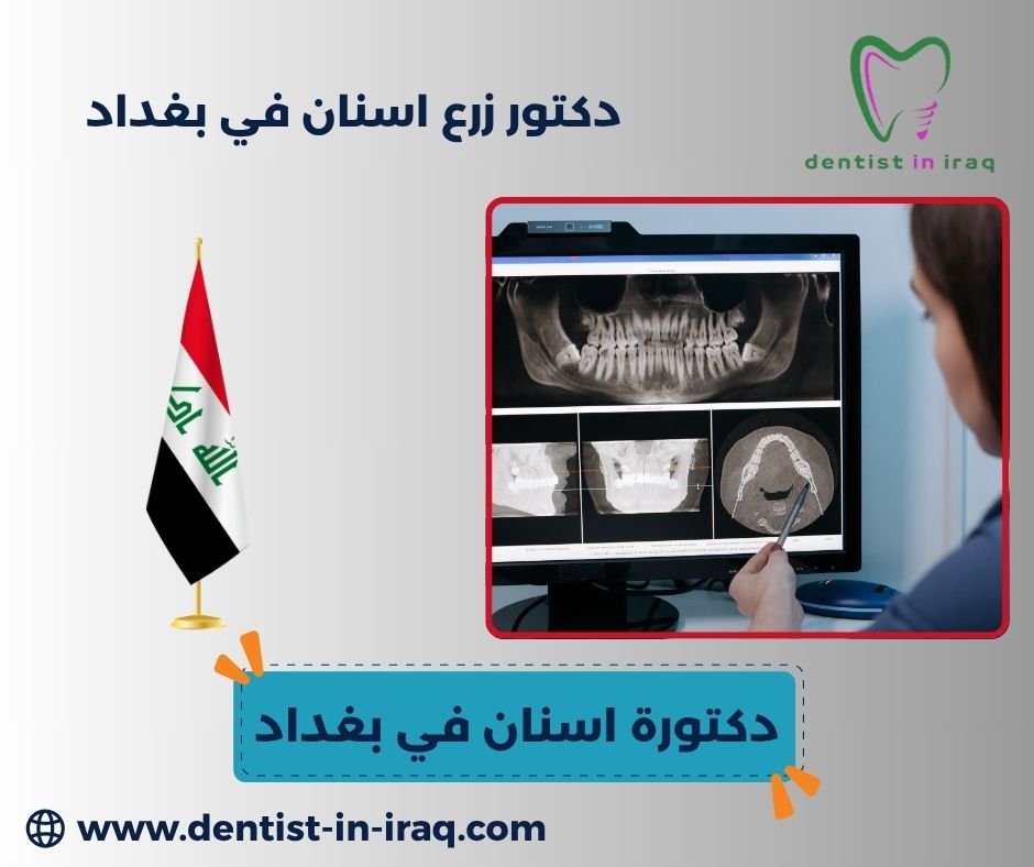 دكتورة اسنان في بغداد دكتورة اسنان في بغداد