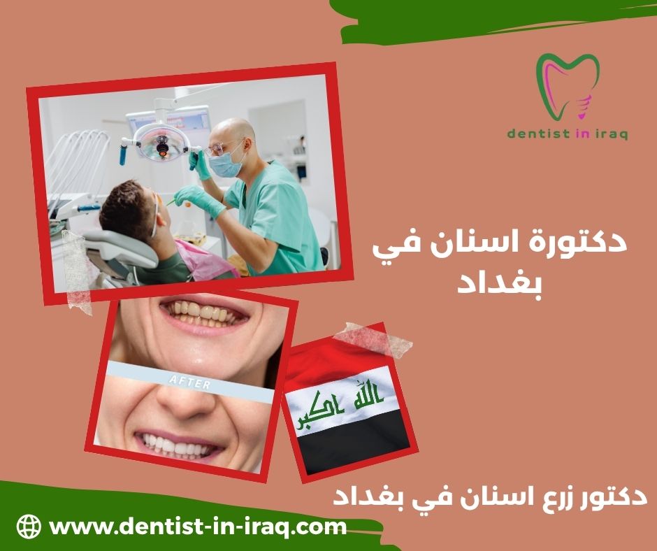 دكتورة اسنان في بغداد