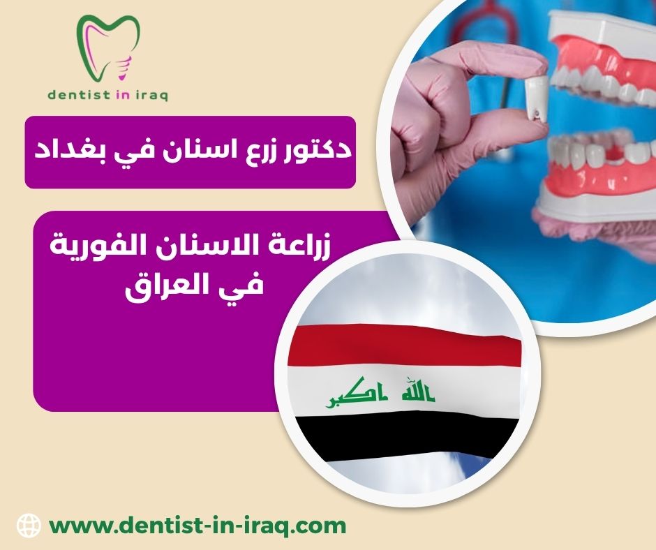 أفضل طبيب اسنان في بغداد أفضل طبيب اسنان في بغداد