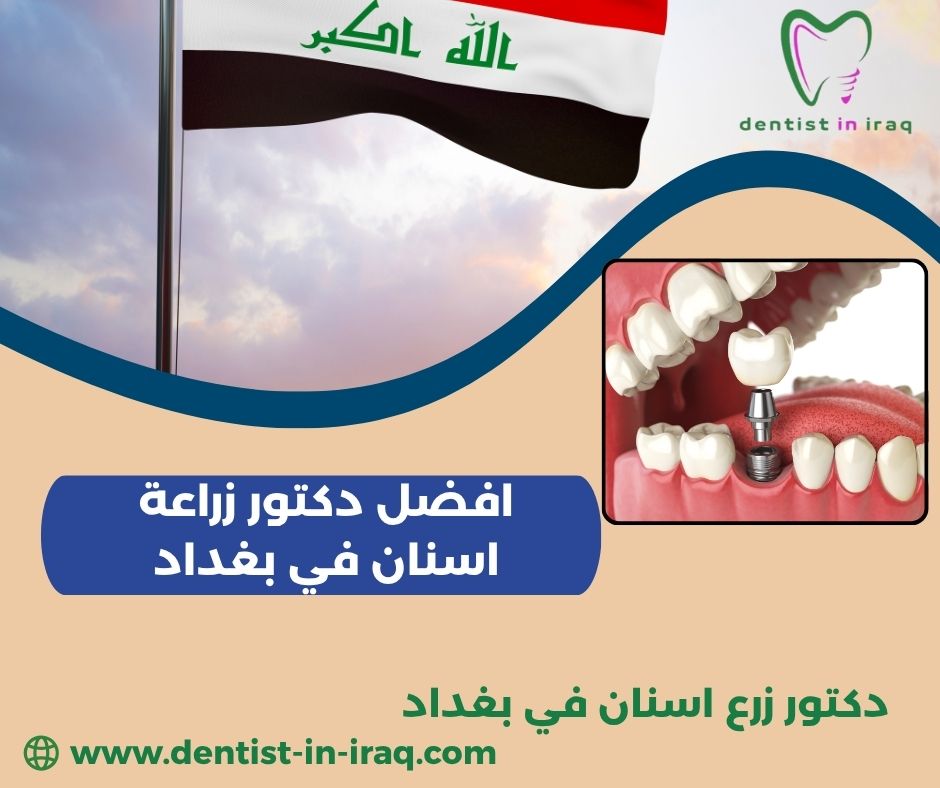 افضل دكتور زراعة اسنان في بغداد