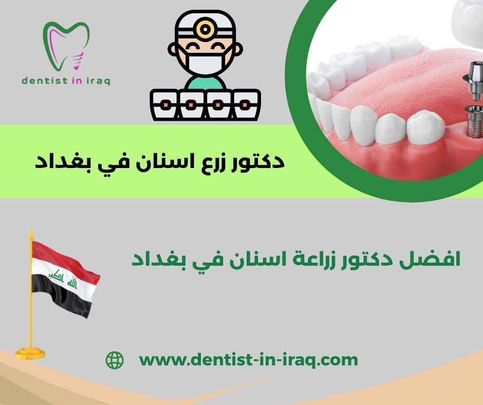 زراعة الاسنان في بغداد