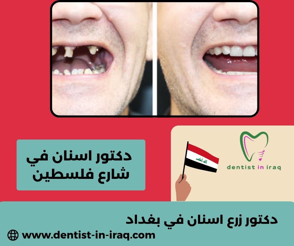 دكتور اسنان في الأعظميه