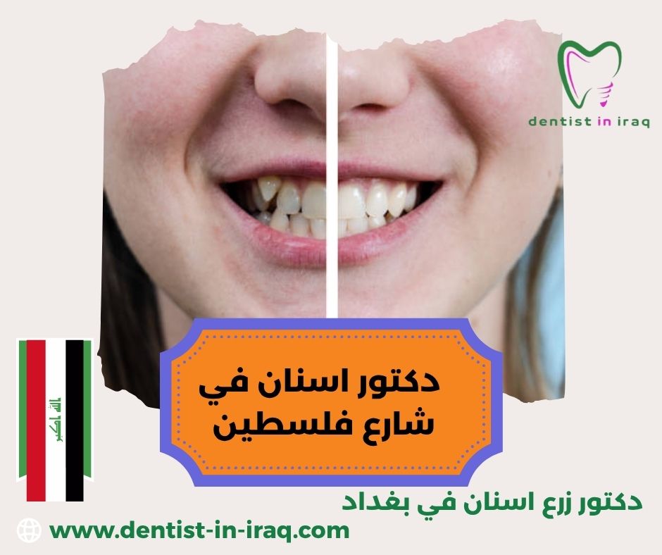 دكتور اسنان في شارع فلسطين