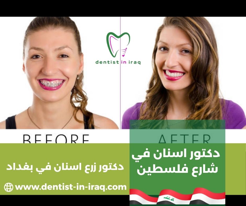 دكتور اسنان في الاعظمية