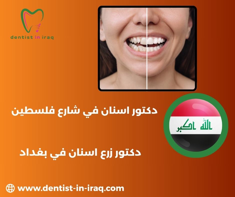دكتور اسنان شارع فلسطين