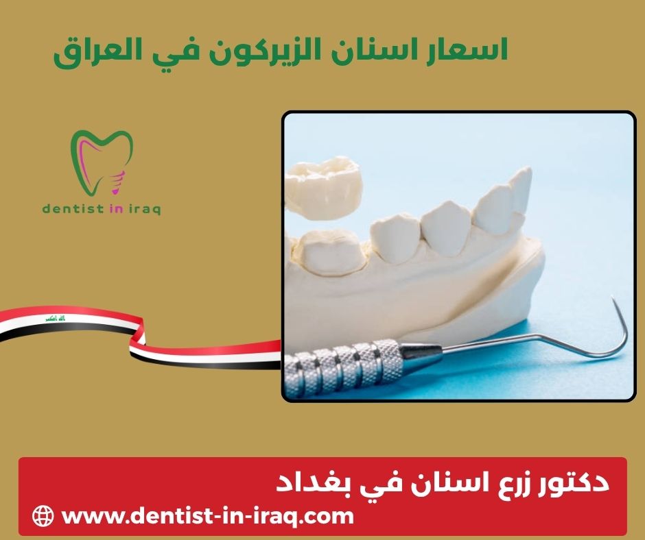 سعر حشوة الجذر في بغداد