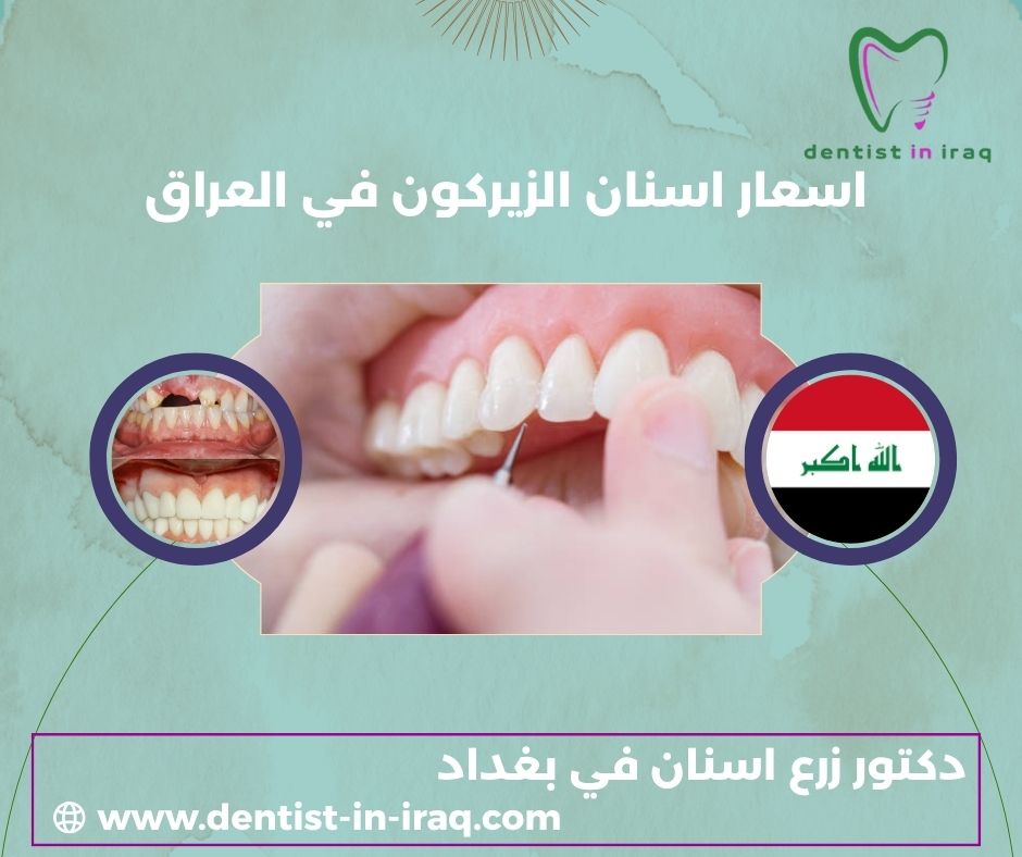 سعر الزيركون الالماني