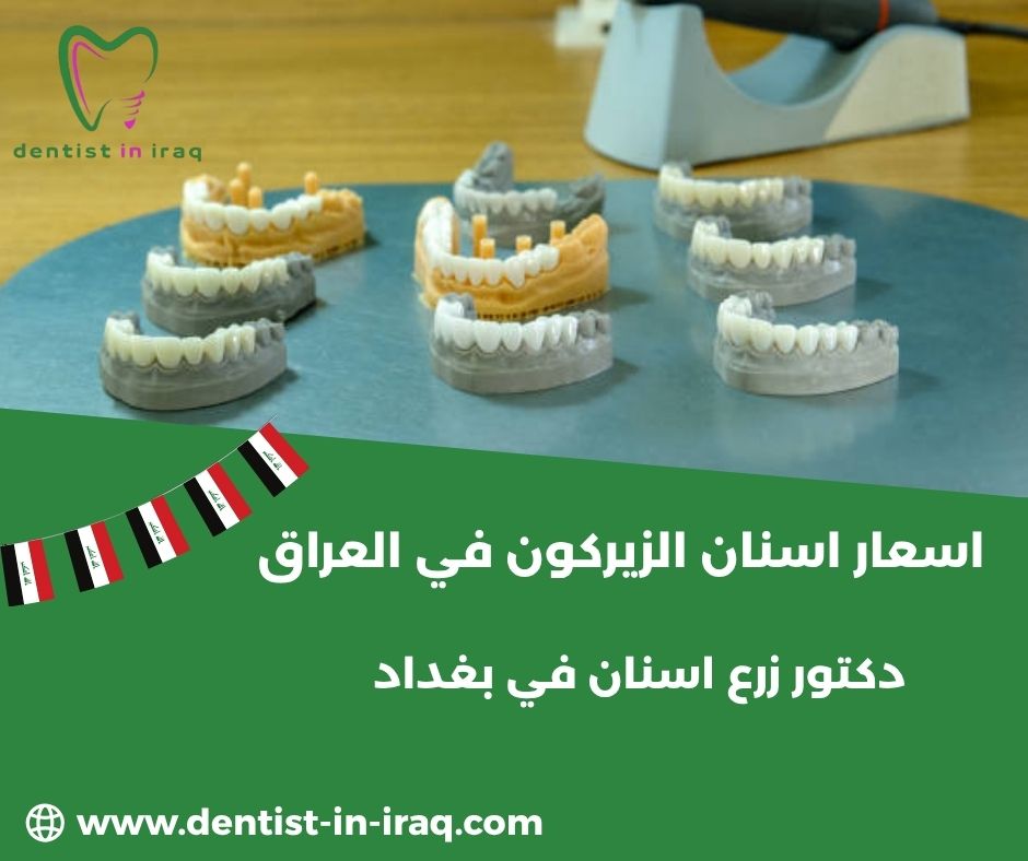 اسعار اسنان الزيركون في العراق