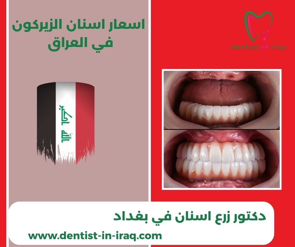 اسعار اسنان الزيركون في العراق