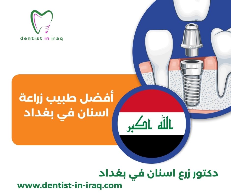 دكتور اسنان في بغداد الجديدة