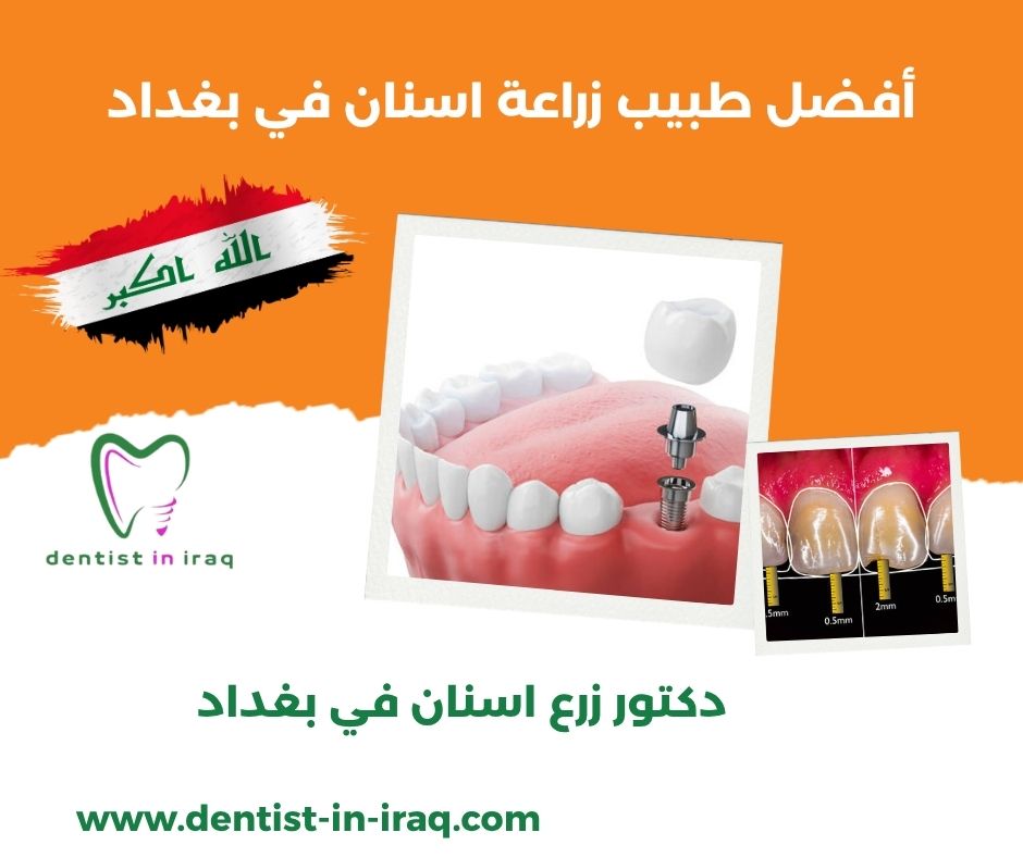 دكتور اسنان في شارع فلسطين