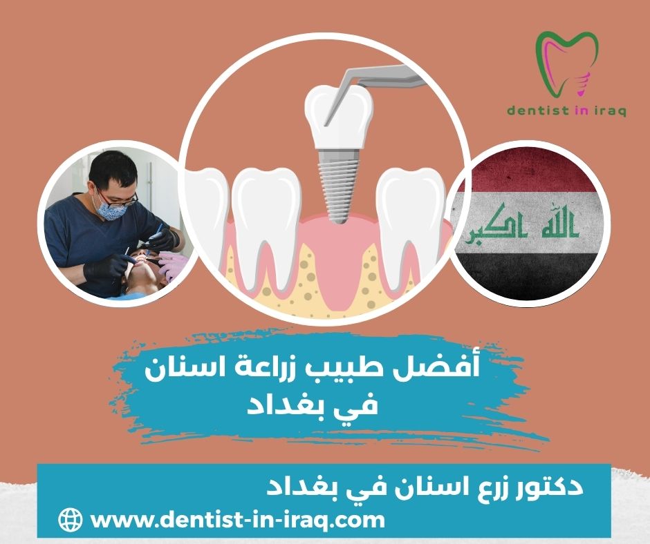 أفضل طبيب اسنان في بغداد