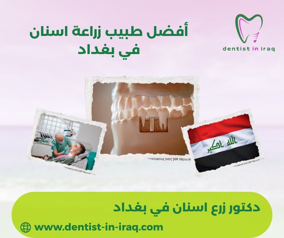 افضل طبيب اسنان في العراق